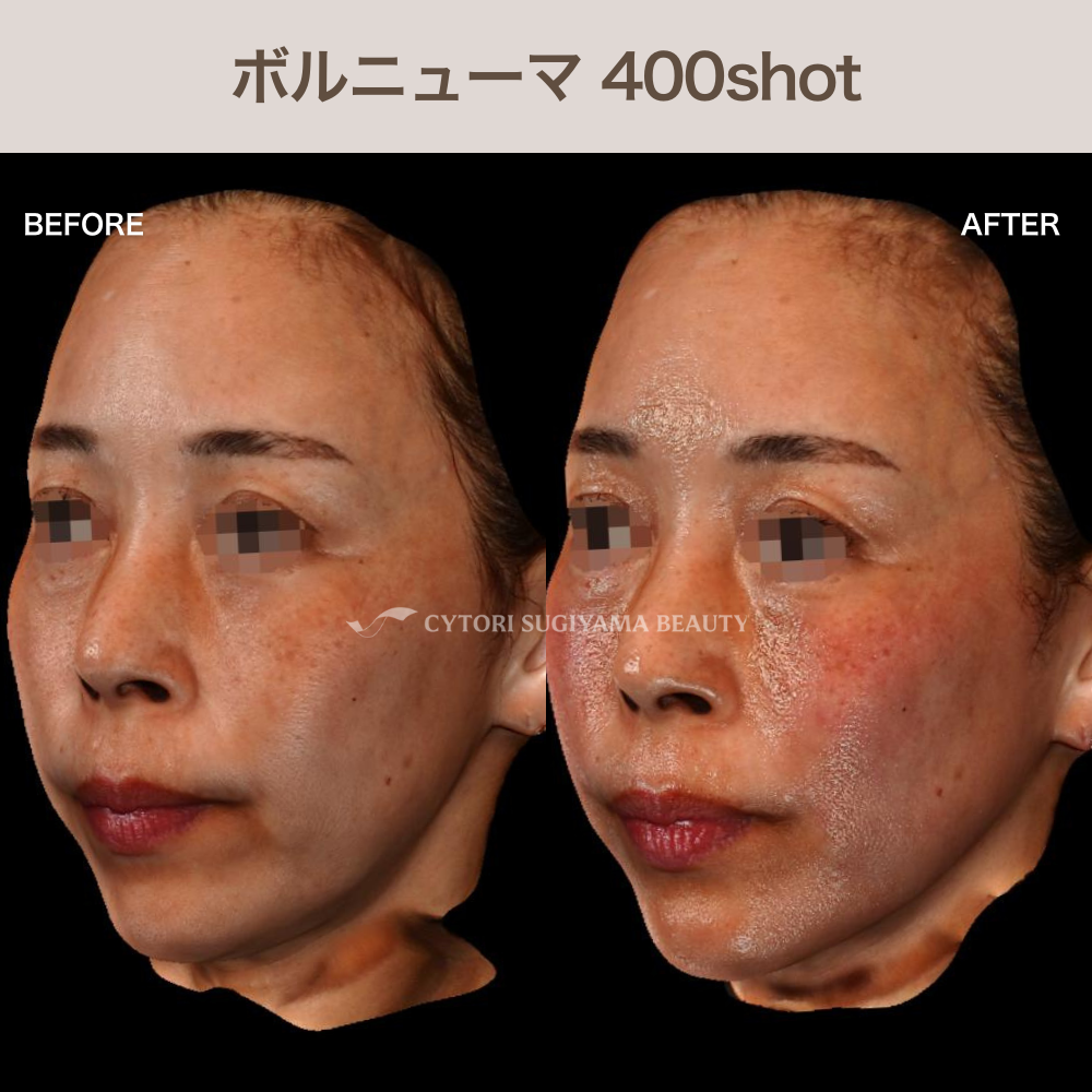 ボルニューマ400shot