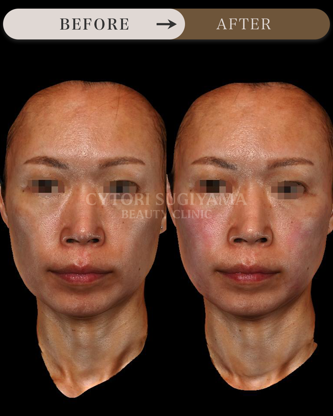 婦人科形成を受けられる前後の画像