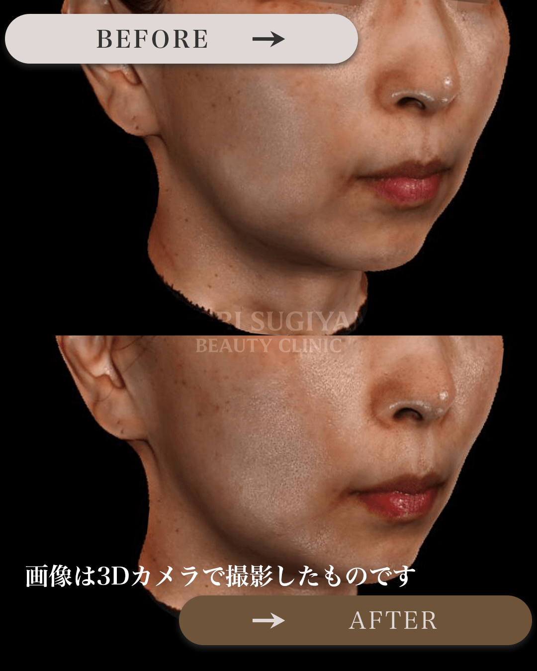 ぽにょりんを受けられる前後の画像